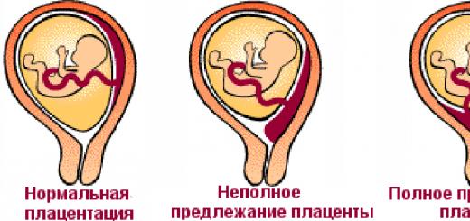 Раждане с маргинална плацента превия