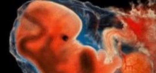 Antenatalna smrt fetusa i njeni uzroci Intrauterina smrt fetusa