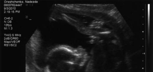 Vaisiaus nuotrauka, pilvo nuotrauka, ultragarsas ir vaizdo įrašas apie vaiko vystymąsi